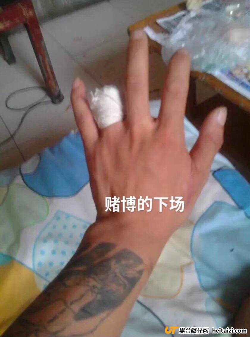 今年34岁,赌博输了几十万,睡公园,捡烟头,乞讨吃饭……(1) 今年34岁,赌博输了几十万,睡公园,捡烟头,乞讨吃饭……(1)